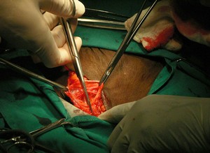 Leistenbruchoperation im Buschspital Leistenbruchoperation im Buschspital